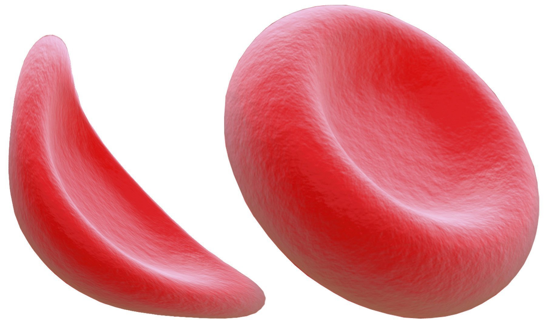 World Sickle Cell Day: FMC Begins free Genotype Screening, tackles sickle cell disease