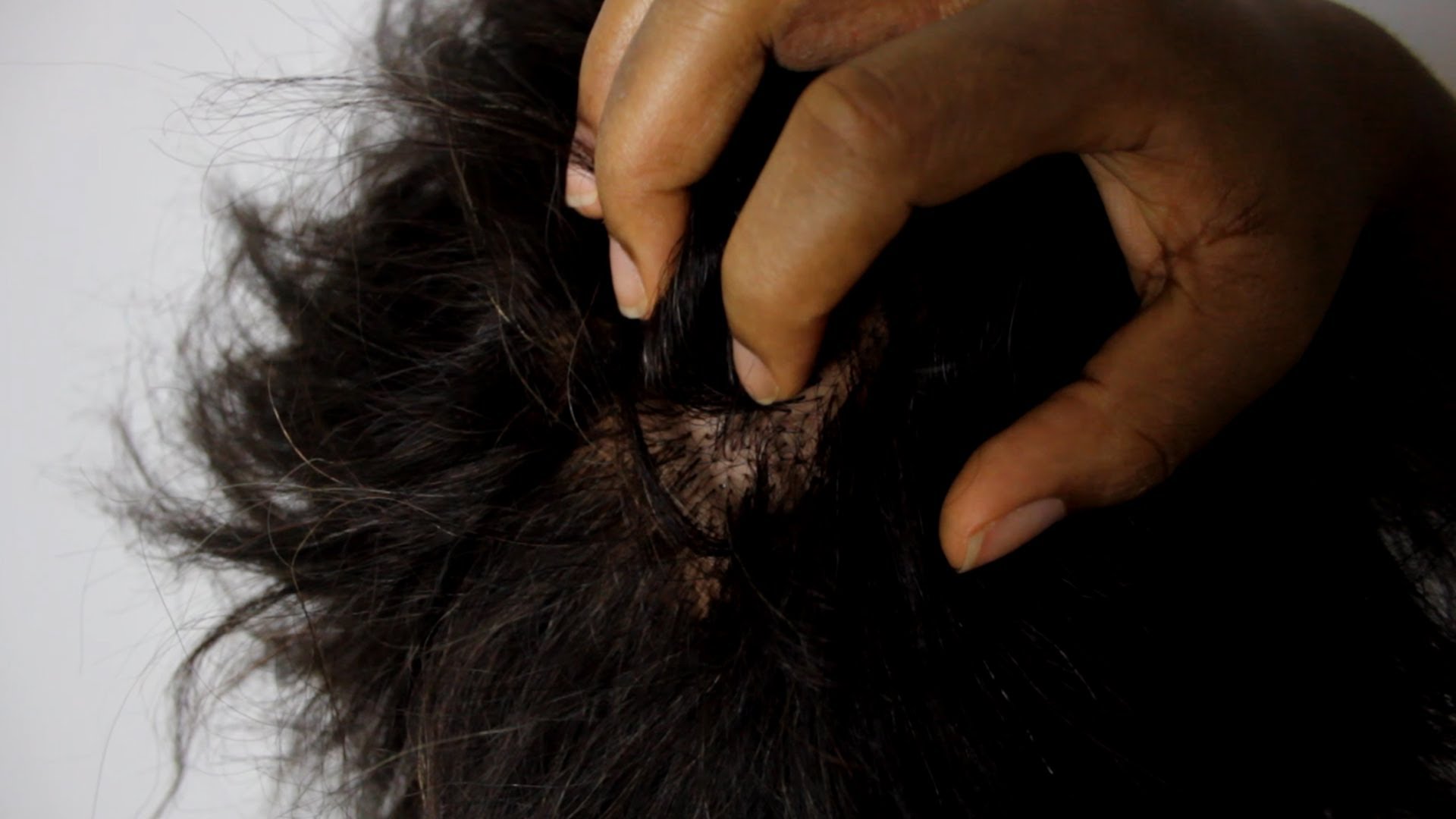 10 Home Remedies For An Itchy Scalp