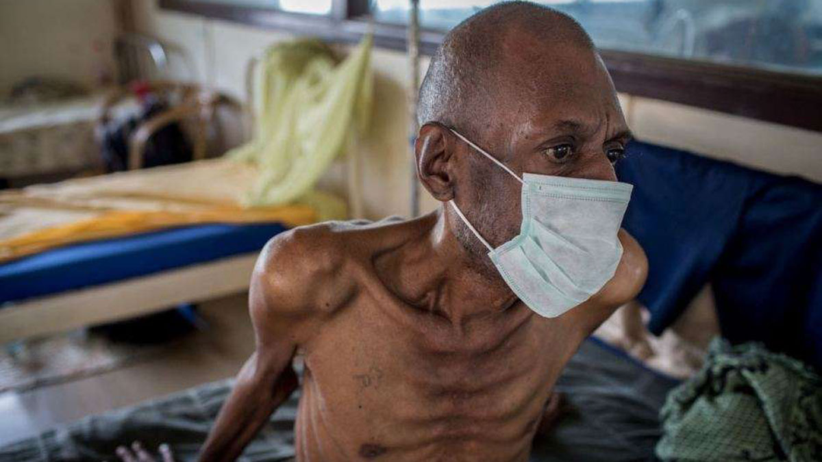 420 Nigerians Die of Tuberculosis Daily - Expert Warns
